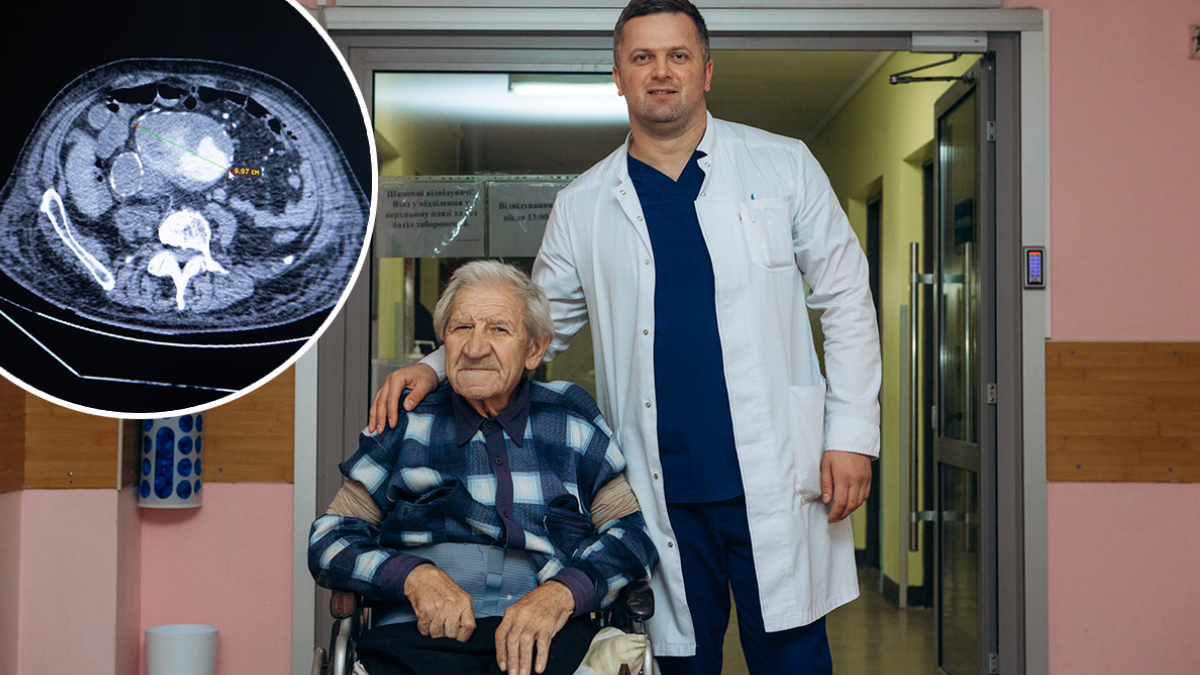У франківській обласній лікарні врятували 70-річного чоловіка з аневризмою аорти