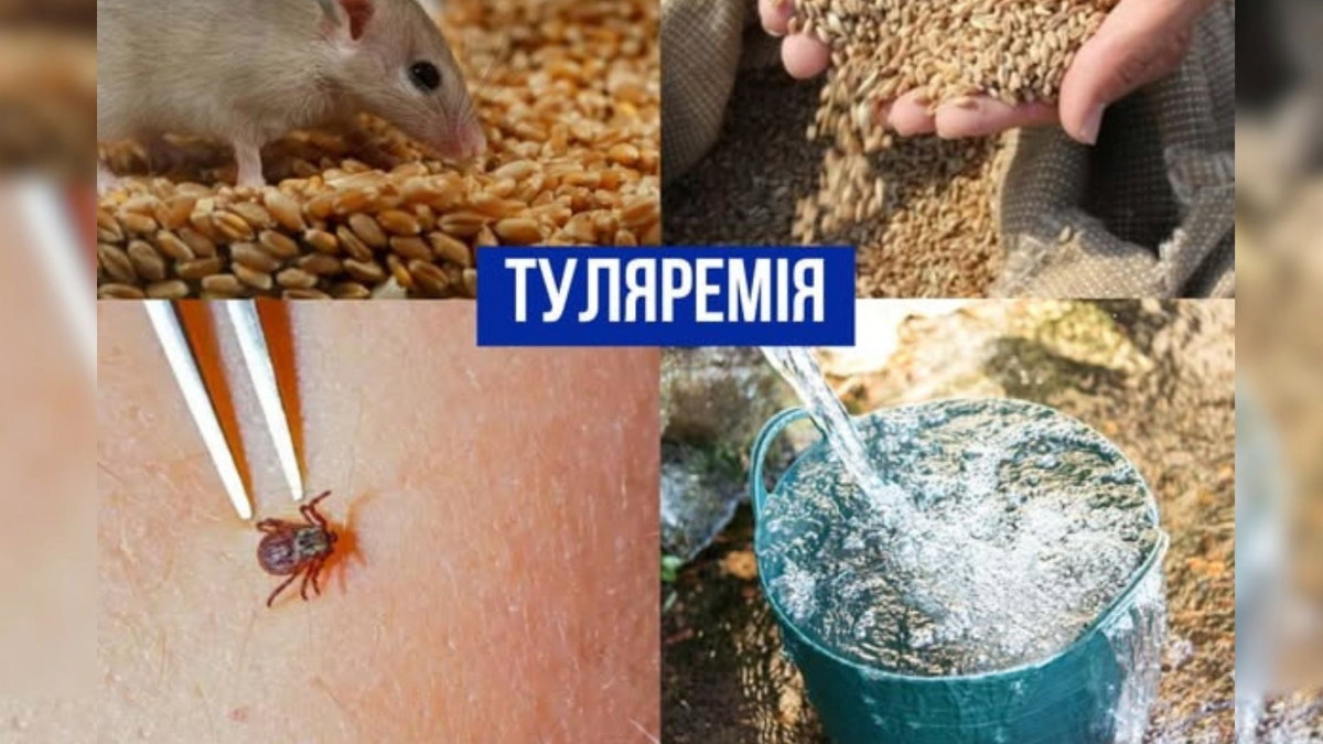 Туляремія
