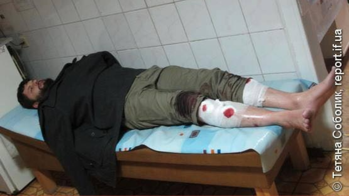 Активіст Євромайдану у Франківську отримав відповідь від ОГП щодо нападу на нього у 2013 році