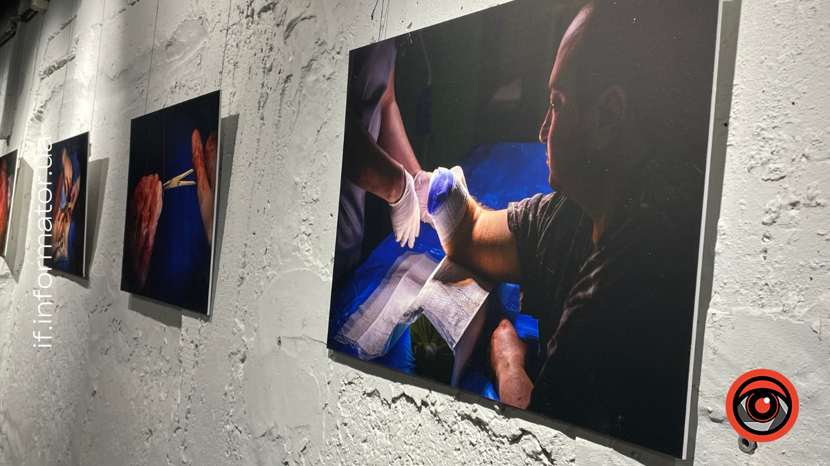 Відкриття фотовиставки "Руки між життям і війною"