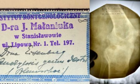 В архівах виявили найдавніший рентгенівський знімок Франківщини