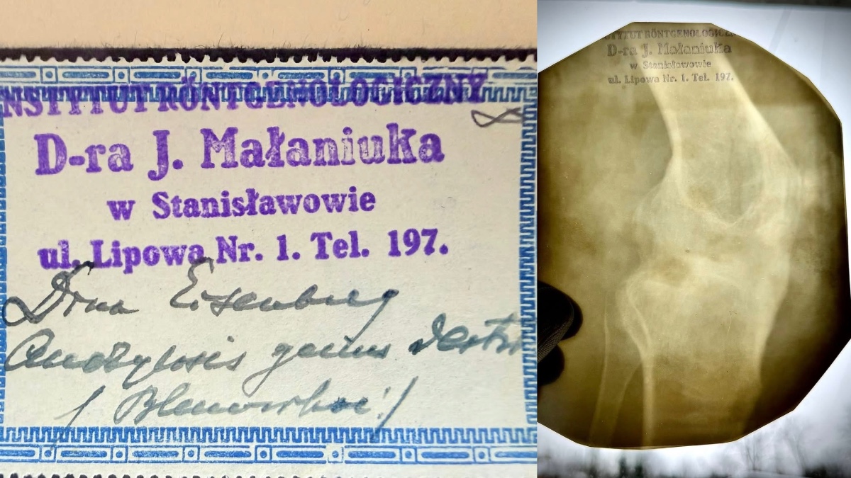 В архівах виявили найдавніший рентгенівський знімок Франківщини