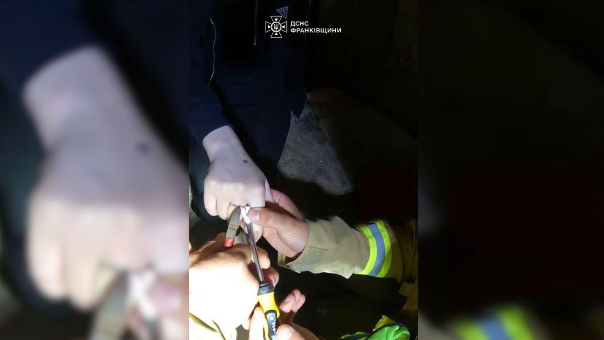 У Франківську жінка не могла зняти каблучку через набряк