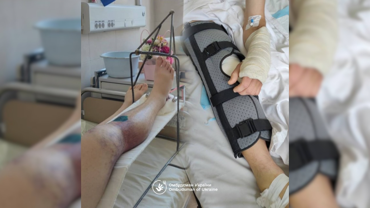 В Івано-Франківському обласному ТЦК та СП відреагували на заяву омбудсмана Дмитра Лубінця щодо побиття 30-річного